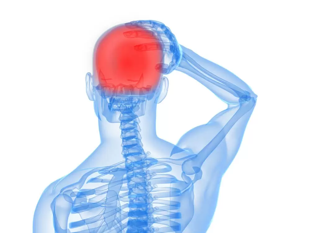 headaches